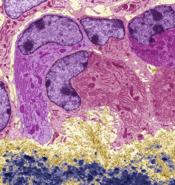 Osteoblasts. Colored transmission electron micrograph (TEM) of osteoblasts, bone-producing cells (purple and pink). They contain rough endoplasmic reticulum (RER), which produces, modifies and transports proteins, and nucleus — Stock Photo