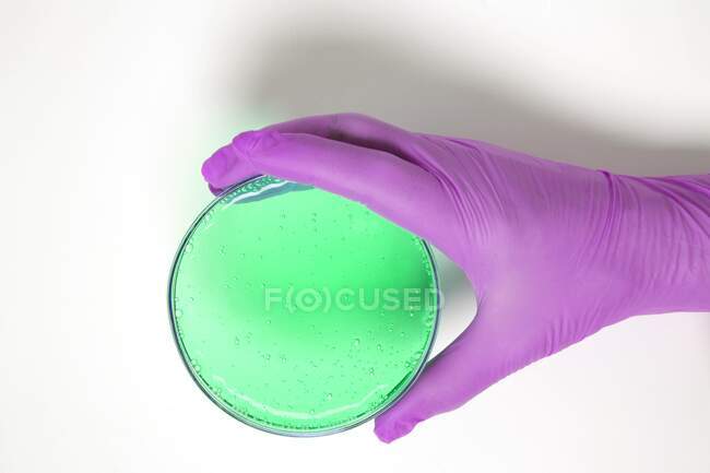 Hand holding a petri dish with green growth medium. — Stock Photo