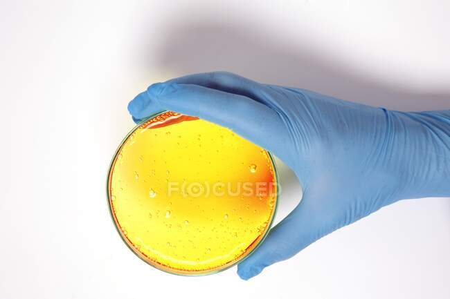Mão segurando uma placa de Petri com ágar amarelo. — Fotografia de Stock
