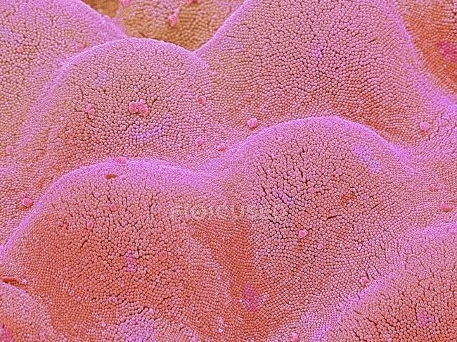 Microvilosidades intestinais. Micrografia eletrônica de varredura colorida (MEV) de microvilosidades do intestino delgado. Estas estruturas minúsculas formam uma densa cobertura em forma de escova nas superfícies absortivas das células que revestem o intestino delgado. — Fotografia de Stock