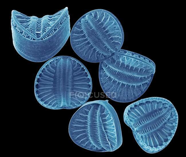 Diatomeas. Micrografía electrónica de barrido de color (SEM) de diatomeas de la especie Campylodiscus. Las diatomeas son un grupo de algas unicelulares fotosintéticas que contienen alrededor de 100.000 especies. - foto de stock