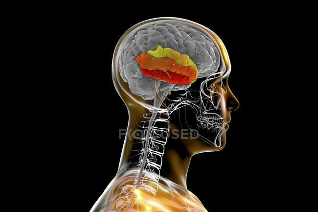 Menschliches Gehirn mit hervorgehobener Temporalkreisel, Computerillustration. Dies zeigt den überlegenen temporalen (gelb), mittleren (orange) und untergeordneten (rot) Gyri. Sie sind an der Verarbeitung auditiver Informationen und der Verschlüsselung des Gedächtnisses beteiligt. — Stockfoto
