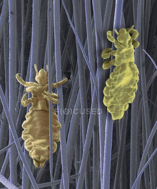 Micrografía electrónica de barrido de color (SEM) de Pediculus humanus capitis, piojos de cabeza humana. P. humanus se divide en dos subespecies; el piojo de la cabeza P. humanus capitis y el piojo del cuerpo P. humanus corporis - foto de stock