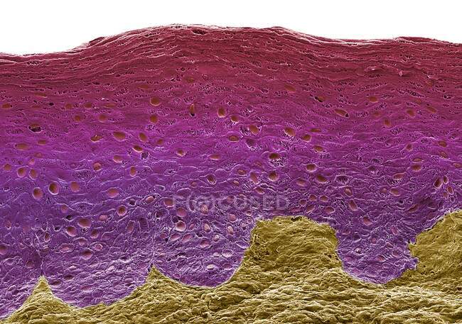 Coloured scanning electron micrograph (SEM) of a freeze fracture of the vagina showing the stratified squamous epithelium and the underlying lamina propria - foto de stock