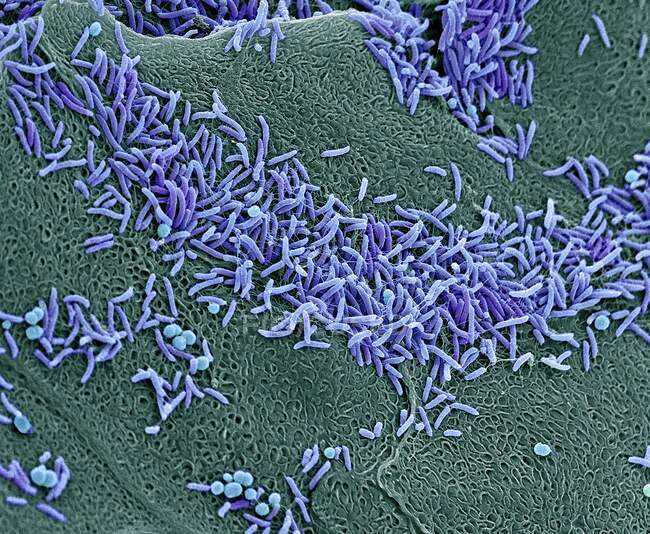 Вагинальные бактерии. цветной сканирующий электронный микрограф (sem) бактерий на вагинальной стенке. здоровая вагинальная флора защищает организм от мочеполовых инфекций — стоковое фото