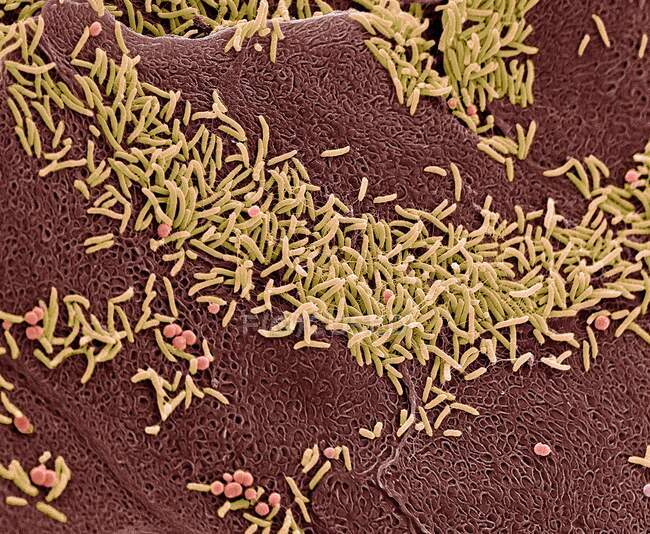 Vaginal bacteria. Coloured scanning electron micrograph (SEM) of bacteria on the vaginal wall. A healthy vaginal flora protects the body against urogenital infections — Stock Photo