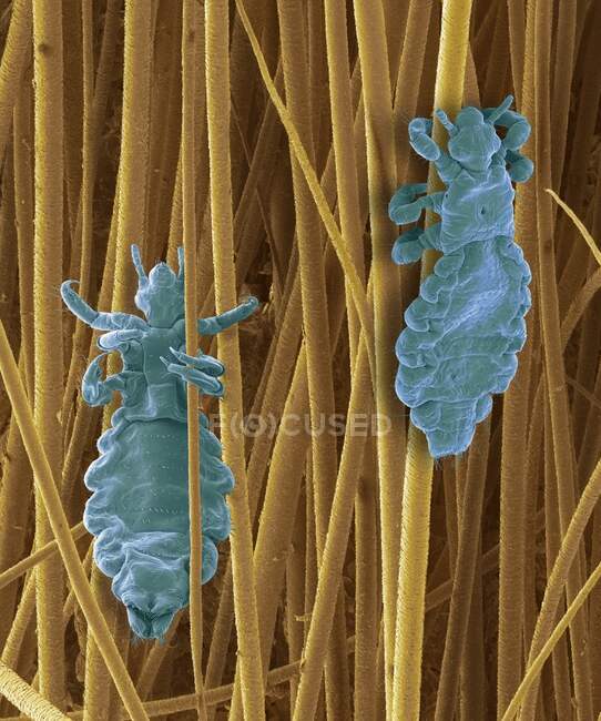Coloured scanning electron micrograph (SEM) of Pediculus humanus capitis, human head lice. P. humanus is divided into two subspecies; the head louse P. humanus capitis and the body louse P. humanus corporis — Stock Photo