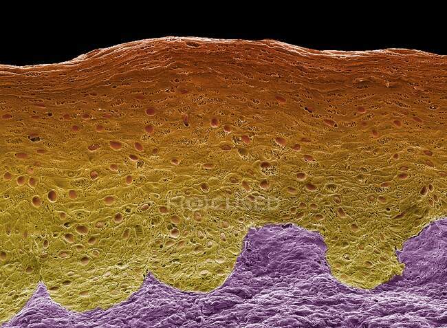 Кольоровий скануючий електронний мікрограф (SEM) морозостійкого перелому вагіни, що показує стратифікований знаменитий епітелій та основні ламінарії — стокове фото