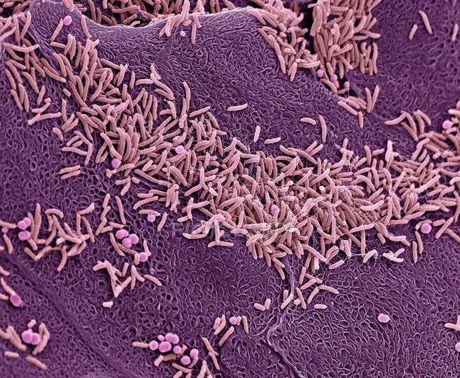 Bactéries vaginales. Micrographie électronique à balayage coloré (MEB) des bactéries sur la paroi vaginale. Une flore vaginale saine protège le corps contre les infections urogénitales — Photo de stock