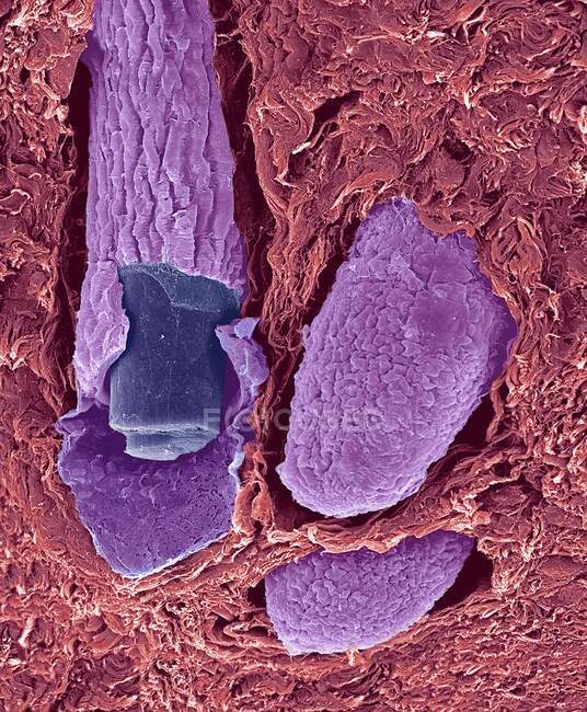 Hair follicles. Coloured scanning electron micrograph (SEM). The outer layer of hair (the cuticle) has overlapping scales of keratin. These scales are thought to prevent hairs from matting together — Stock Photo