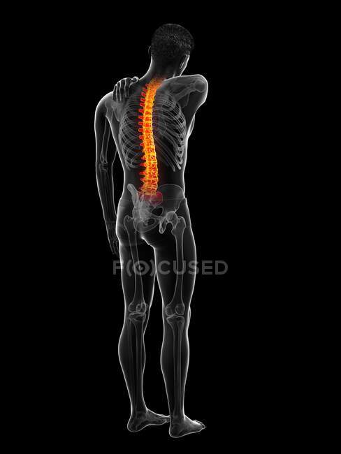 Человек с болью в спине, компьютерная иллюстрация — стоковое фото
