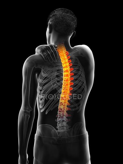 Hombre con dolor de espalda, ilustración por ordenador - foto de stock