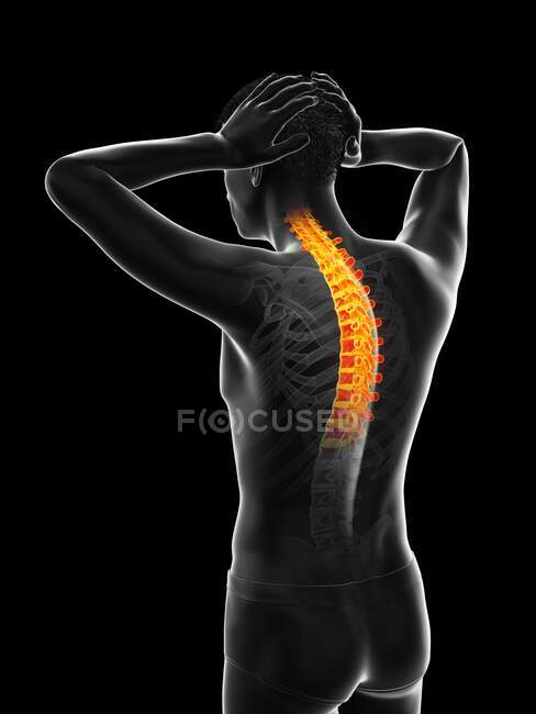 Uomo con mal di schiena, illustrazione al computer — Foto stock