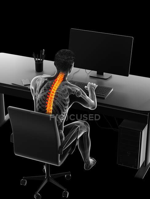 Человек с болью в спине из-за сидения, компьютерная иллюстрация — стоковое фото