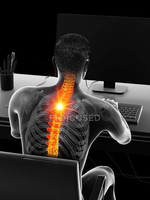 Man with backache due to sitting, computer illustration — Stock Photo