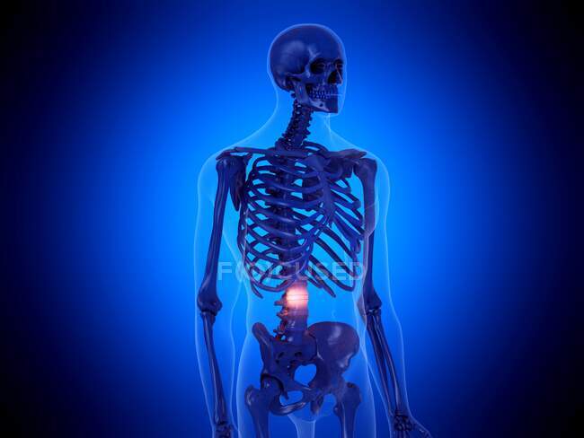 Painful spine, computer illustration — Stock Photo