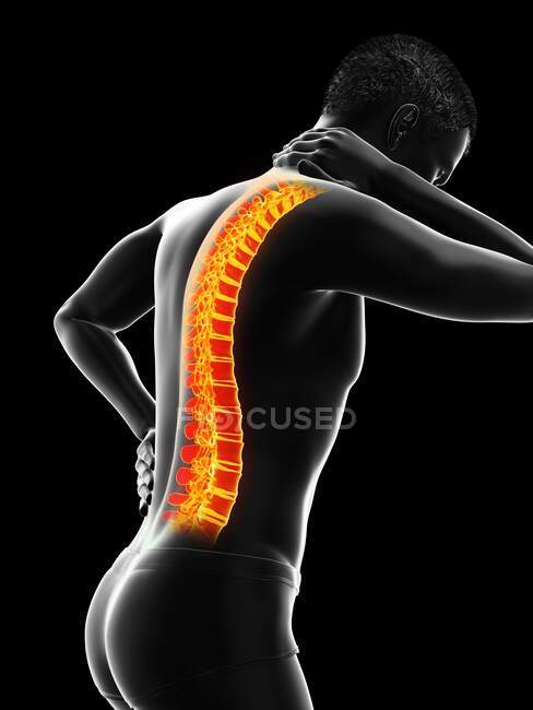 Man with backache, computer illustration — Stock Photo