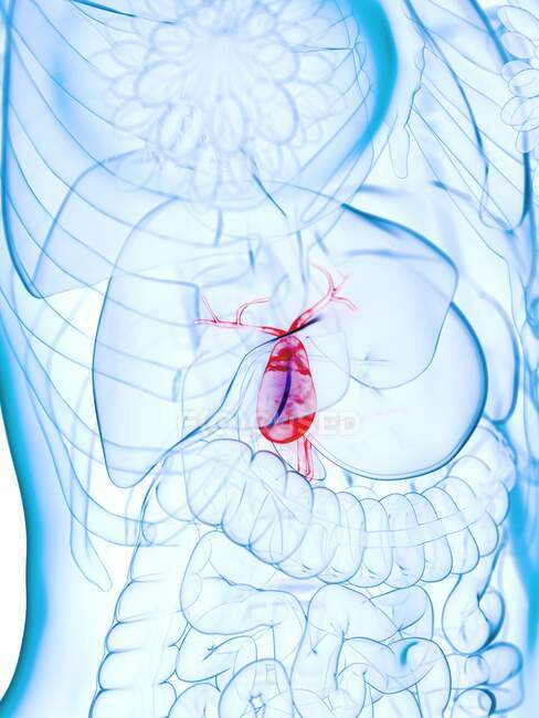 Diseased gallbladder, computer illustration — Stock Photo