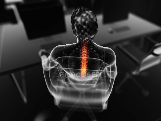 Homme avec mal de dos, illustration informatique — Photo de stock