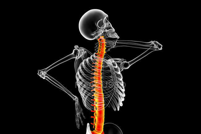 Dolor de cuello humano, ilustración por computadora. - foto de stock
