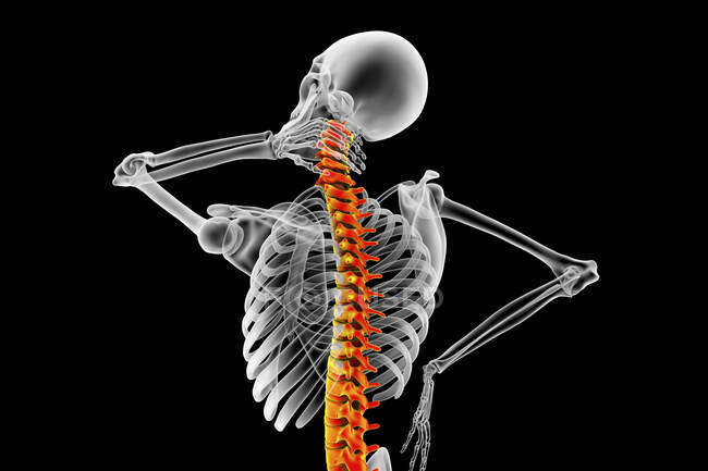 Human neck pain, computer illustration. — Stock Photo