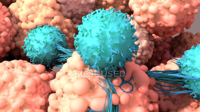 Close-up de células T (turquesa) de ligação às células cancerosas (rosa), ilustração. Os linfócitos T, ou células T, são um tipo de glóbulos brancos e componentes do sistema imunitário do corpo. Eles amadurecem no timo — Fotografia de Stock
