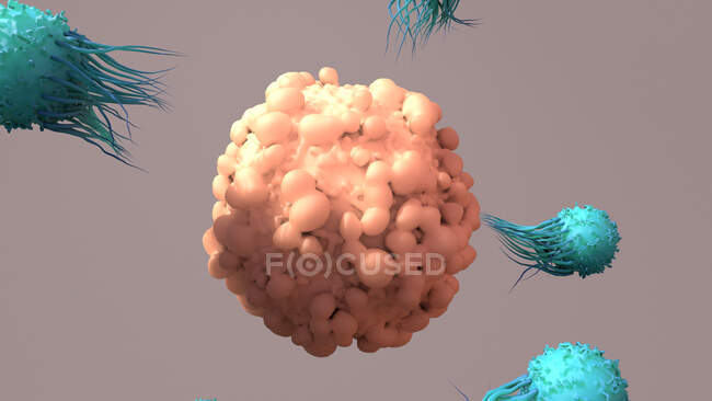 Células T (turquesa) que rodean un tumor (rosa), ilustración. Los linfocitos T, o células T, son un tipo de glóbulos blancos y componentes del sistema inmunitario del cuerpo. Maduran en el timo - foto de stock