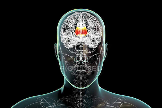 Cerebro humano con cuerpo calloso resaltado, también conocido como comisura callosa, ilustración. Es un tracto nervioso ancho y grueso que conecta los hemisferios cerebral izquierdo y derecho.. - foto de stock