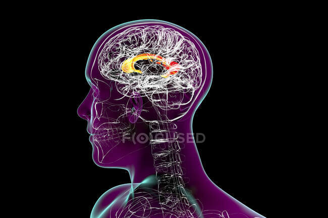 Human brain with highlighted corpus callosum, also known as callosal commissure, illustration. It is a wide, thick nerve tract connecting the left and right cerebral hemispheres. — Stock Photo