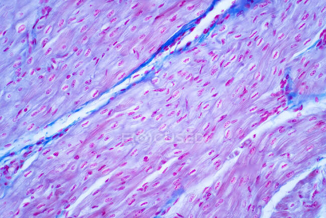 Menschlicher Herzmuskel, leichte Mikrographie. Hämatoxylin und Eosin-Fleck. — Stockfoto