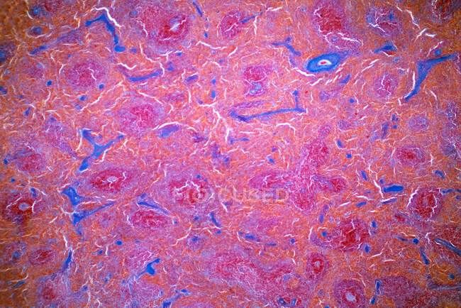 Microscópio de luz de um baço. O baço é a maior massa de tecido linfático do corpo. Mancha de hematoxilina e eosina. — Fotografia de Stock