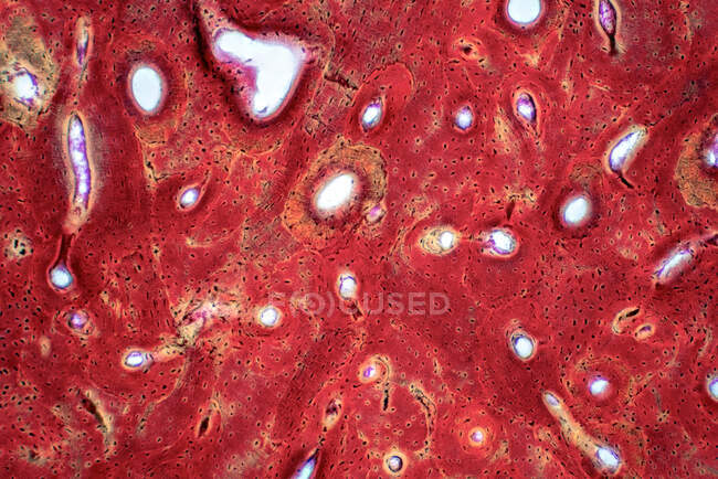 Tecido ósseo compacto humano, micrografia de luz. Mancha de hematoxilina e eosina. — Fotografia de Stock