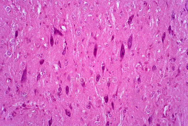 Рухові нейрони, легкий мікрограф. Рухові нейрони спинного мозку є частиною центральної нервової системи. Гематоксилін та еозин.. — стокове фото