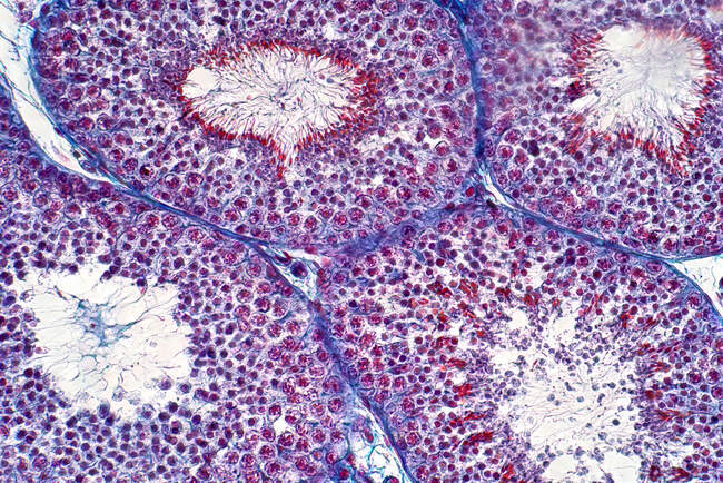 Lichtmikroskopische Aufnahme menschlicher Hoden, die Spermatogonien, Spermatozyten in der Meiose, Spermatiden und Spermatozoen zeigt. Hämatoxylin und Eosin-Fleck. — Stockfoto