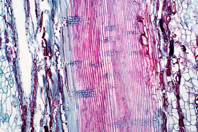 Pflanzliches Gefäßgewebe, leichte Mikrographie. Hämatoxylin und Eosin-Fleck. — Stockfoto