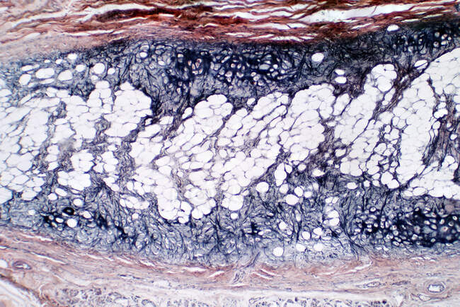 Micrographie photonique d'une coupe transversale de cartilage et d'os humains. Tache d'hématoxyline et d'éosine. — Photo de stock