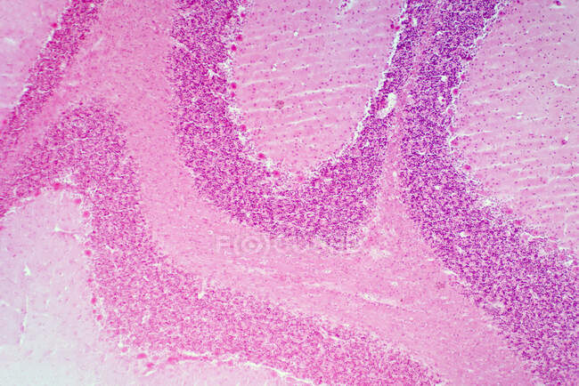 Cerebellum, micrographie photonique. Tache d'hématoxyline et d'éosine. — Photo de stock