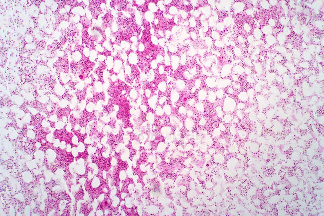 Human bone marrow, light micrograph. Haematoxylin and eosin stain. — Stock Photo