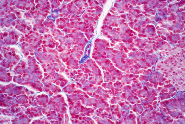 Клітини гепатоцитів, легкий мікрограф. Гепатоцити є основними клітинами паренхімальної тканини печінки. Гематоксилін та еозинозамінна фарба . — стокове фото