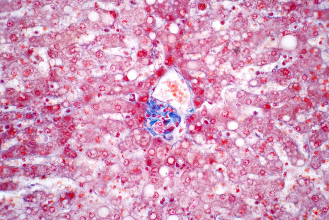 Клітини гепатоцитів, легкий мікрограф. Гепатоцити є основними клітинами паренхімальної тканини печінки. Гематоксилін та еозинозамінна фарба . — стокове фото