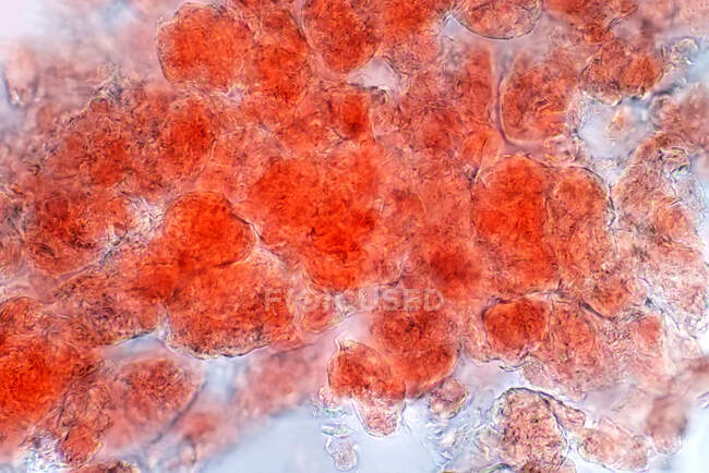 Micrografo leggero del tessuto adiposo contenente grandi goccioline lipidiche. — Foto stock