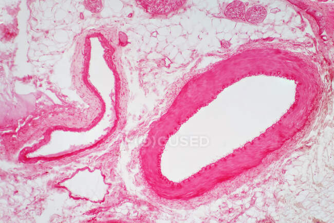 Световой микрограф сосудистого поперечного сечения артерии. — стоковое фото