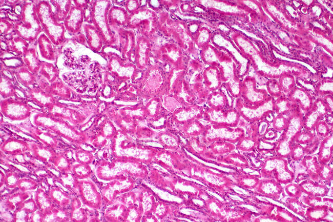 Людська ниркова тканина, легкий мікрограф. Гематоксилін та еозин.. — стокове фото