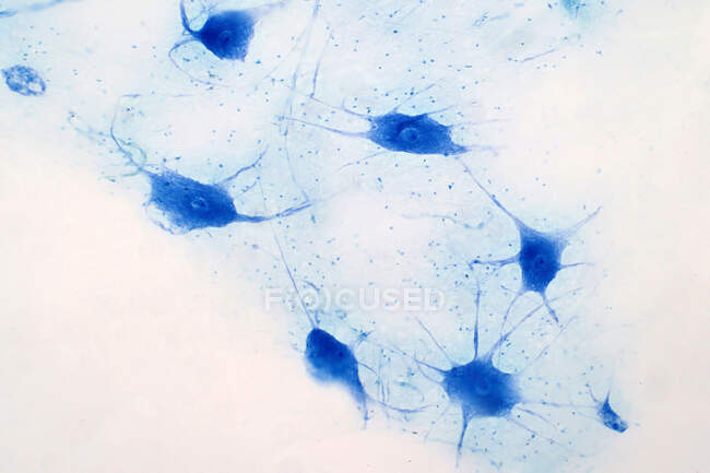 Células nervosas, micrografia de luz. Mancha de hematoxilina e eosina. — Fotografia de Stock