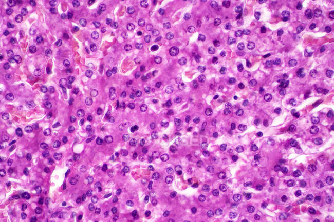 Células hepatocitarias, micrografía ligera. Las células hepatocitarias son las principales células del tejido parenquimatoso del hígado. Tinción de hematoxilina y eosina. - foto de stock