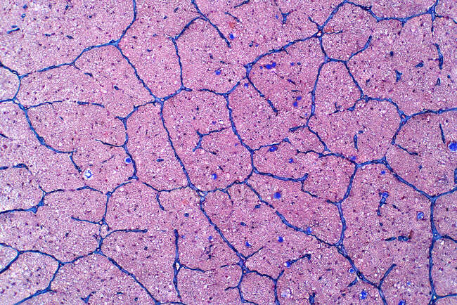 Людський нерв, легкий мікрограф. Гематоксилін та еозин.. — стокове фото