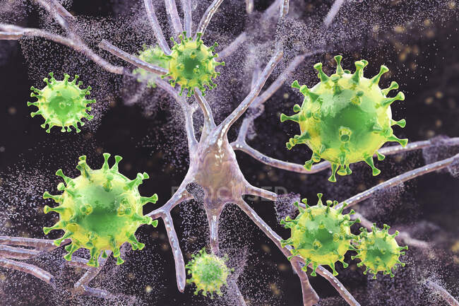 Концептуальна ілюстрація вірусного енцефаліту це запалення мозку, викликане вірусом . — стокове фото