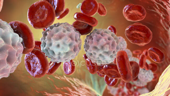 Ilustración de linfocitosis, mostrando abundantes glóbulos blancos dentro del vaso sanguíneo. - foto de stock