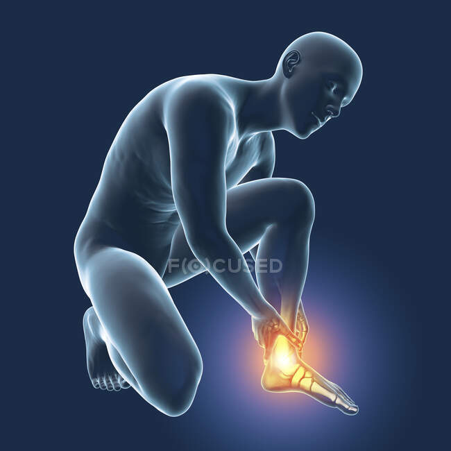 Uomo con dolore ai piedi e scheletro evidenziato, illustrazione al computer. — Foto stock