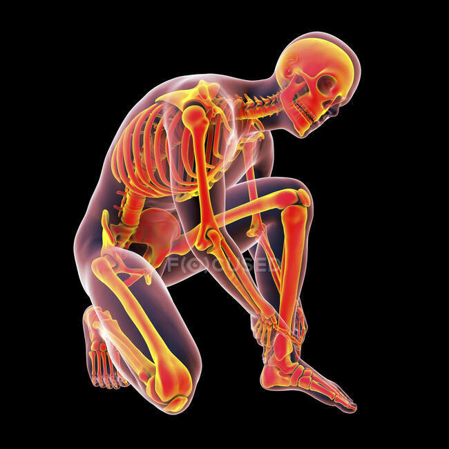 Людина з болем у ногах і підсвіченим скелетом, комп'ютерна ілюстрація . — стокове фото